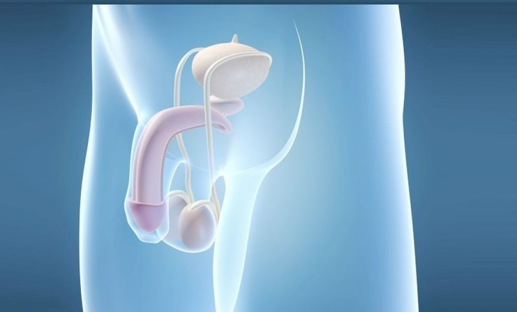 Implantation of a prosthesis is a surgical method of enlarging the male penis